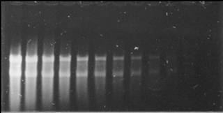 Comparison of glyoxalated RNA stained with ethidium bromide and with the SYBR&reg; Gold Nucleic Acid Gel Stain.