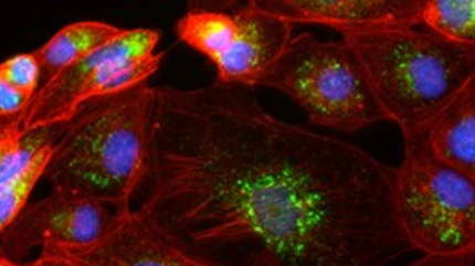 ReadyProbes Cell Stain 