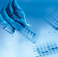 การแยกโปรตีนโดยวิธีเจลอิเลคโตรโฟรีซีส (Gel electrophoresis of protein)