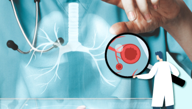 ภัยเงียบ ติดง่าย ใกล้ตัว  “วัณโรคระยะแฝง”