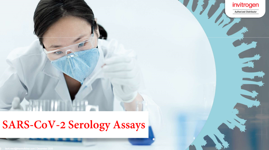 การตรวจทางภูมิคุ้มกันหรือแอนติบอดีที่จำเพาะต่อ SARS-CoV-2 (SARS-CoV-2 Serology Assays)