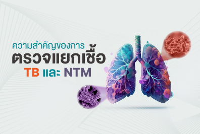 ความสำคัญของการตรวจแยกเชื้อ TB และ NTM